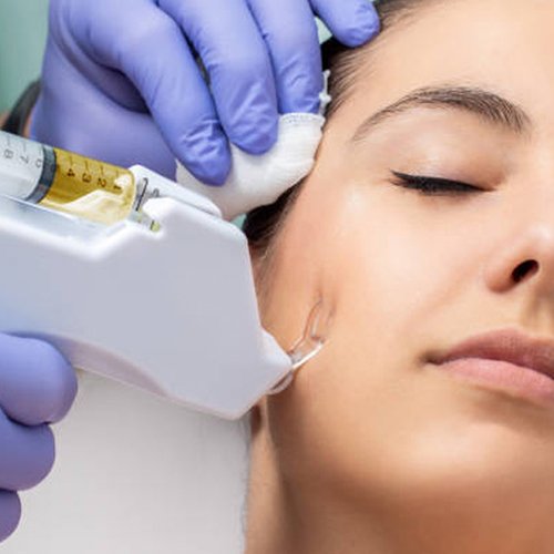 PRP – Platelet  Rich Plasma